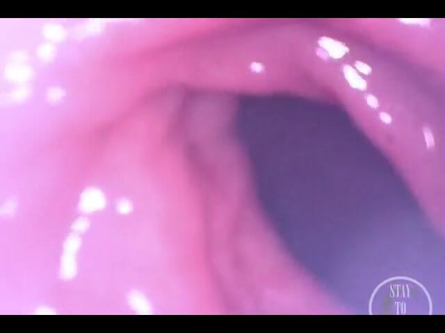 Lina Free: POV extrem tiefe anal-untersuchung!