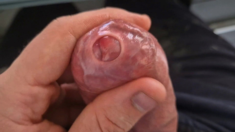 GloomyChase977: Tight Foreskin Stroking Until I Leak Everywhere
