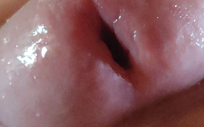 DaddyDoted: Dilation of the Glans Eye Has a Pleasant Surprise.
