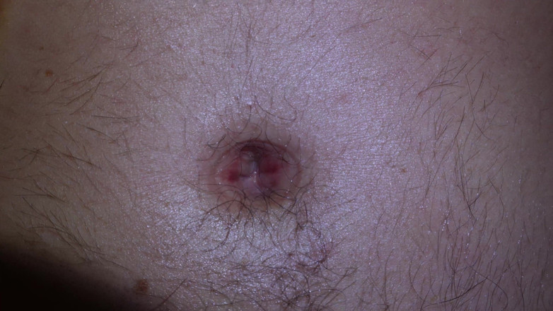 Navel fans: 알렉스의 깊은 배꼽: 빨아, 밖으로 밀려 및 묶인 쪼이는