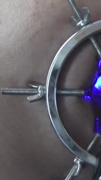Backdoor Lightshow
