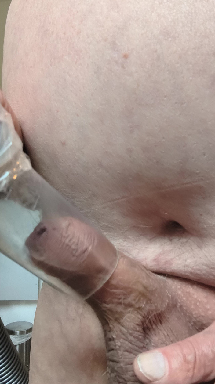 Karlchengeil: Shave and Suck