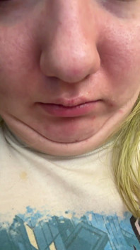 Chin Faces