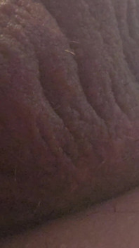 Penis