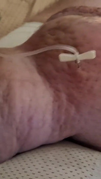 Extreme Fillings Inside My Siliconemeat