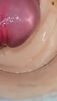 Cumfeti, Compilation De Creampies Dégoulinants - Vue Sur L’endoscopie