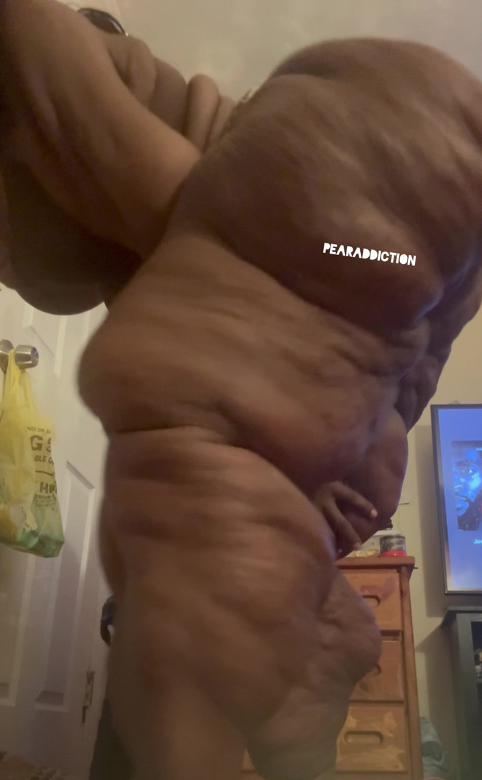 Pearaddiction: Мій бічний профіль божевільний