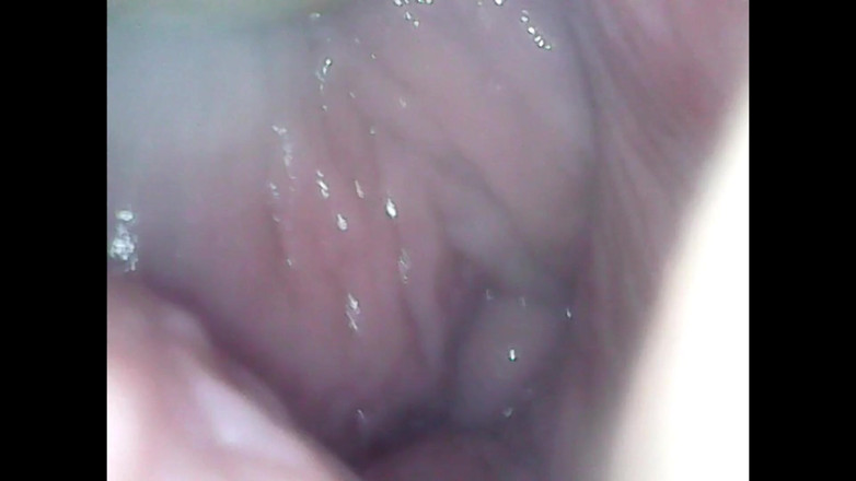 LizAngel: Je me masturbe avec un endoscope dans mon vagin