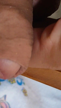 Jonge papa krijgt een röntgenfoto met zijn gerimpelde lul.