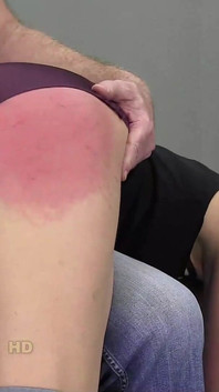 Luca bella dicambuk di sofa