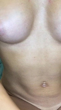 Buceta, Cu, Axilas E Partes Do Corpo Em Close-ups Extremos, Fetiche Peluda