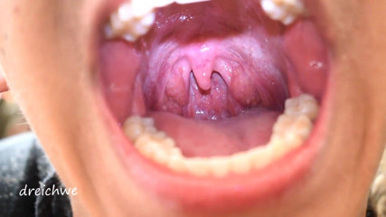 Dreichwe: Uvula fetish mouth
