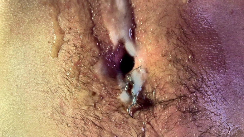 Navel fans: Stomp &amp; Ice - 热、冷和完全控制