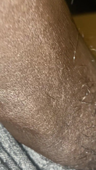 Meat Teaser