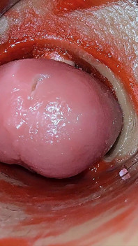 Camera Inside Deep Pussy Captures Overdose Ejaculation of Sperm Asmr