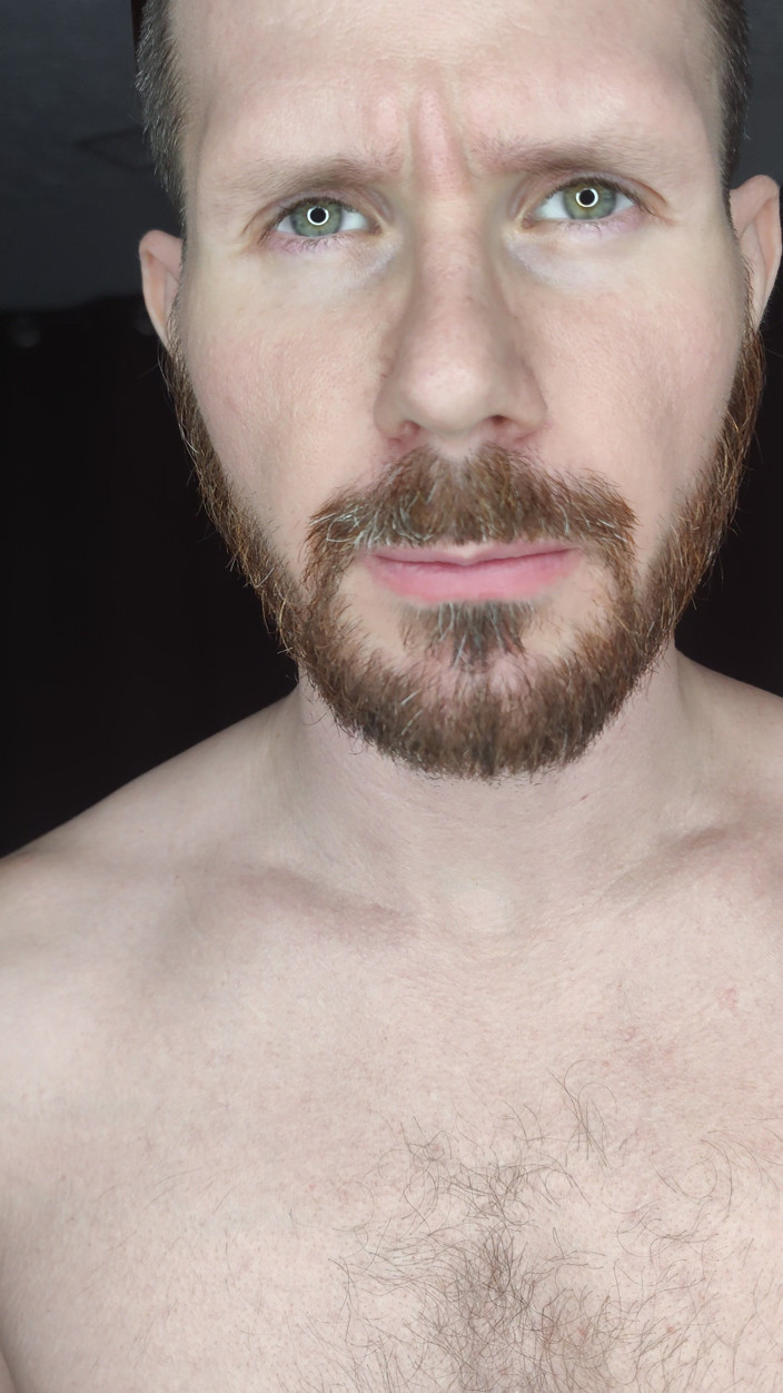 Albino Adonis: ようこそ