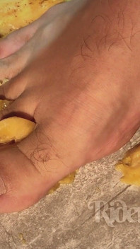 Hairy Feet and Banana Smash