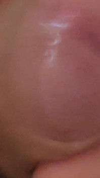 Immense Phimosis Being Extracted Cum and Précum.