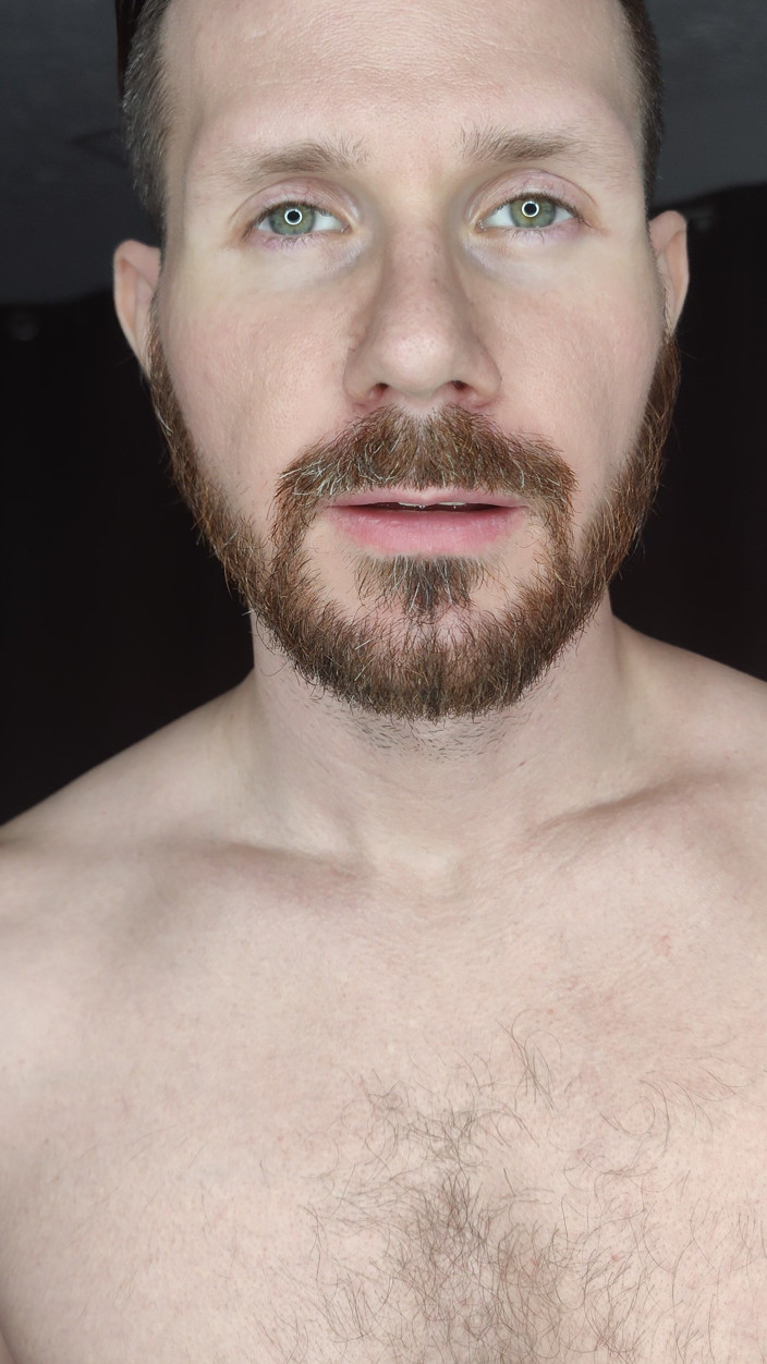 Albino Adonis: 환영