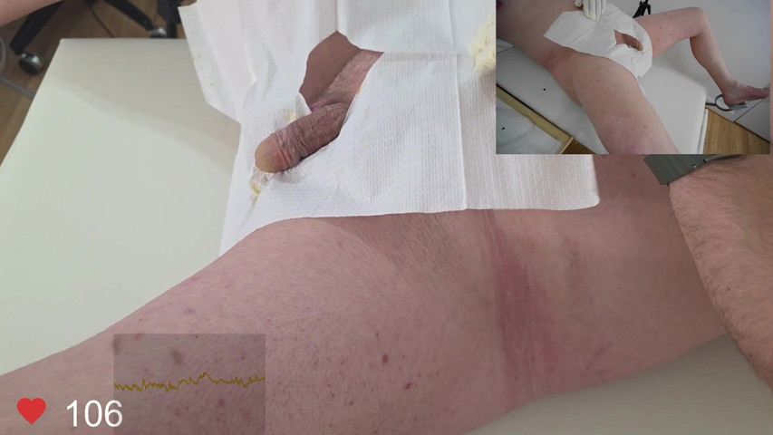 16 French Foley Insertion (Clinical Climax)