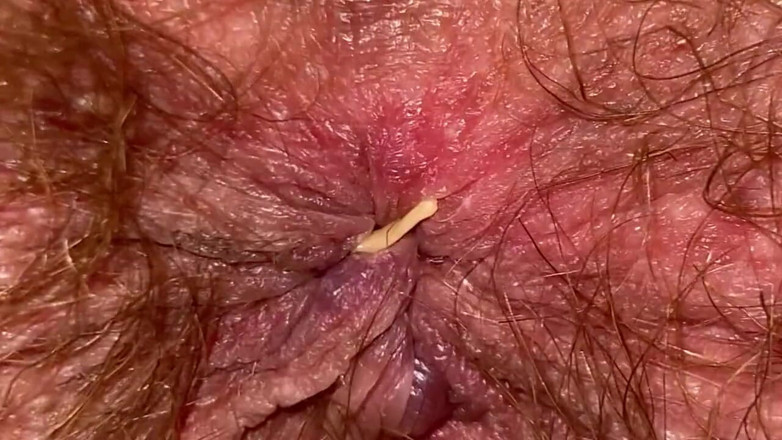 Cuteblonde666: Extreme nahaufnahme großer kitzler vagina arschloch mund riesin fetisch video...
