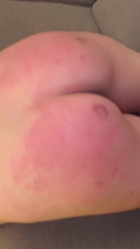 善后合集