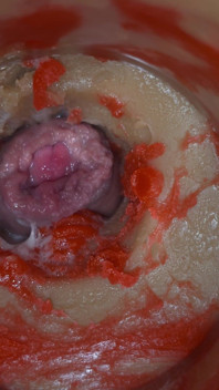 Inseminacja - kamera wewnętrzna przechwytuje głęboki wytrysk mężczyzn