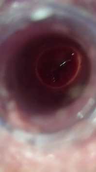 Lỗ đít nóng bỏng của tôi