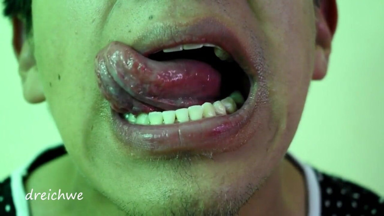 Dreichwe: Delicious tongue