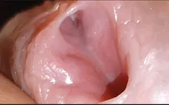 Amazing Glans
