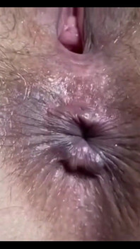 Buraco anal close-up, você pode ver todos os cabelos. A bunda é peluda, fodida por sexo anal frequente. Parte 2