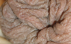 Straight Daddy Club: L’ouverture Et La Fermeture Du Plus Grand Phimosis Du Monde.