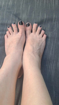 Do We See How Beguiled My Throbbing Foot Veins Are