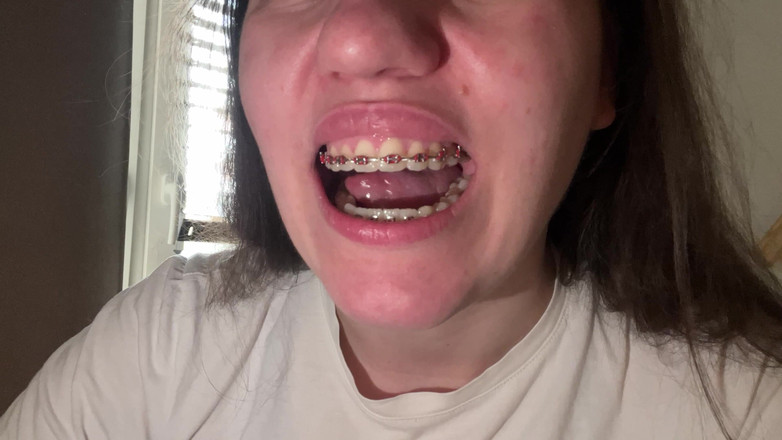 NicoleRay: Lambendo aparelho com a língua