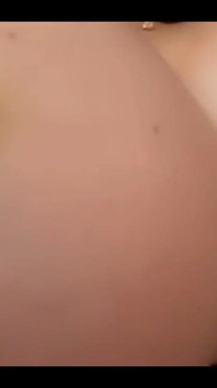 Bruise on Tits Update