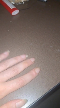 긴 발톱 두드리기