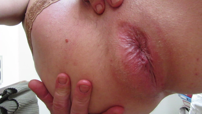E-Werk 2000: Anal Insertion