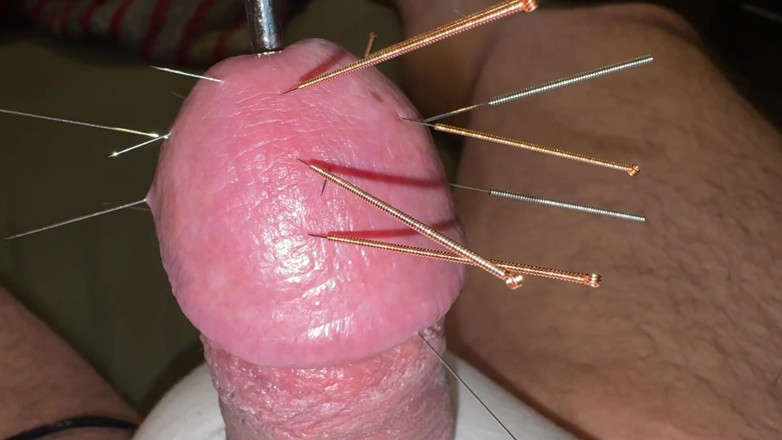 Qualzucht: Acupuncture - Orgasm!