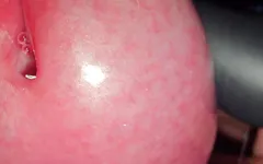 Microscopic Close up on My Penis