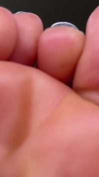 Wrinkly Toes up-close