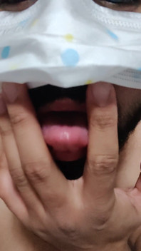 Dickontop