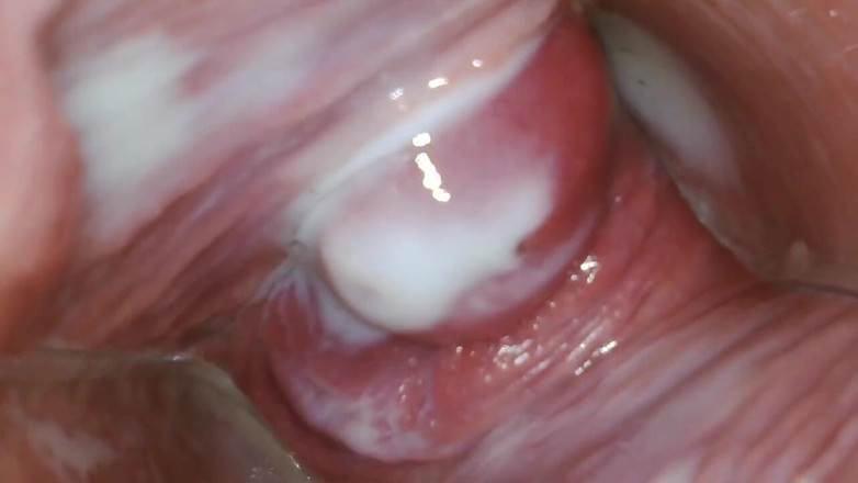 JANA studios: Endoscope in my pussy