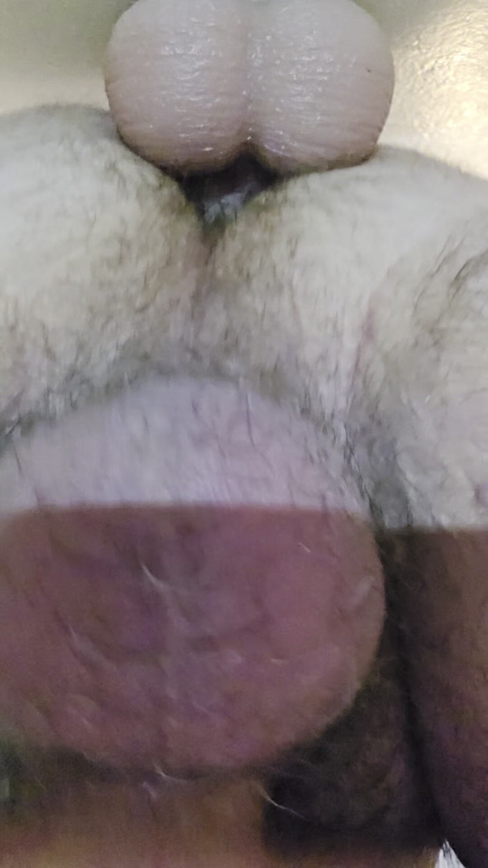 Beary Jax: Chi ha messo quel dildo sul Muro?