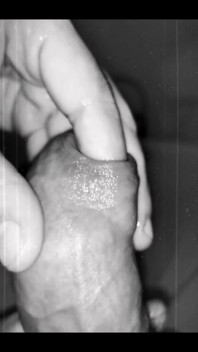 Foreskin Play