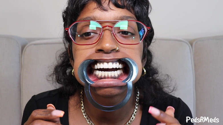 PedsRMeds: Youronlyphoenix Dental Retractor Usta wycieczka