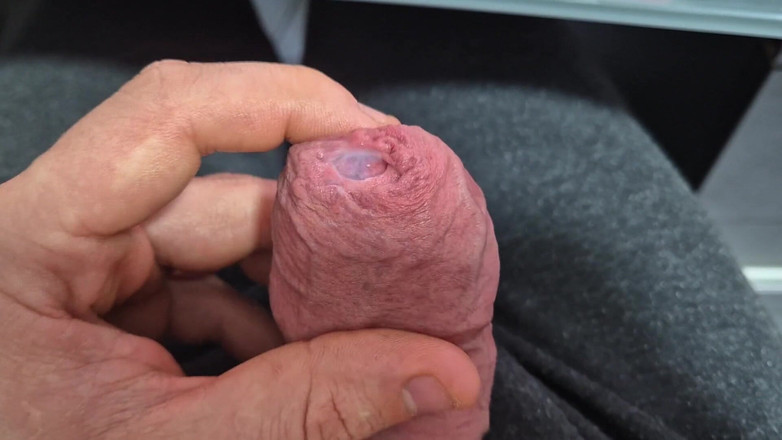 GloomyChase977: Těsná předkožka se protahuje s výstřikem!