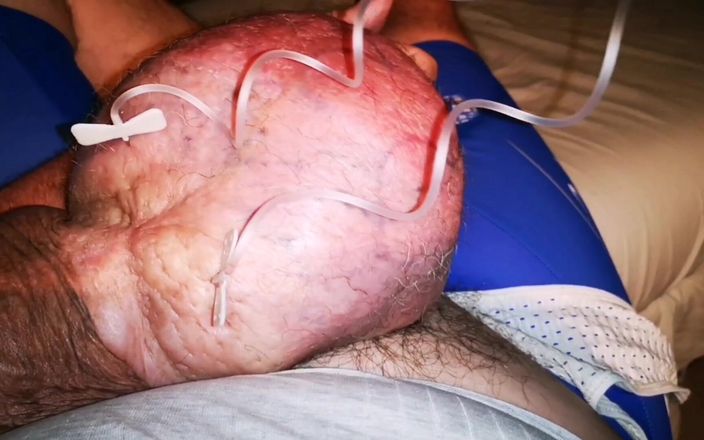 Monster_Meat_: एक ही समय में 2 लीटर ग्लूकोज भरना