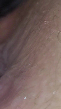Caping Hole