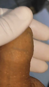 V lékařské kanceláři nanesu horké lepidlo na mého ptáka