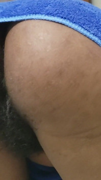 Scopami adesso